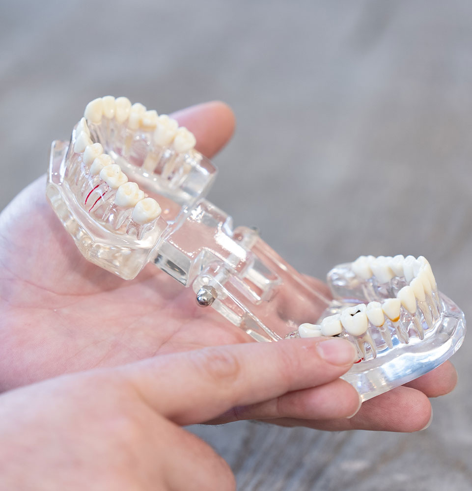 close up of dental implant model